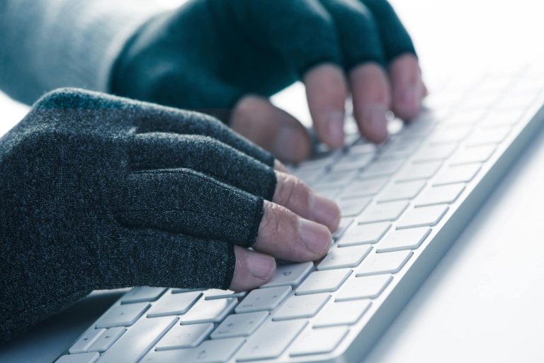 A man wearing compression gloves working on computor